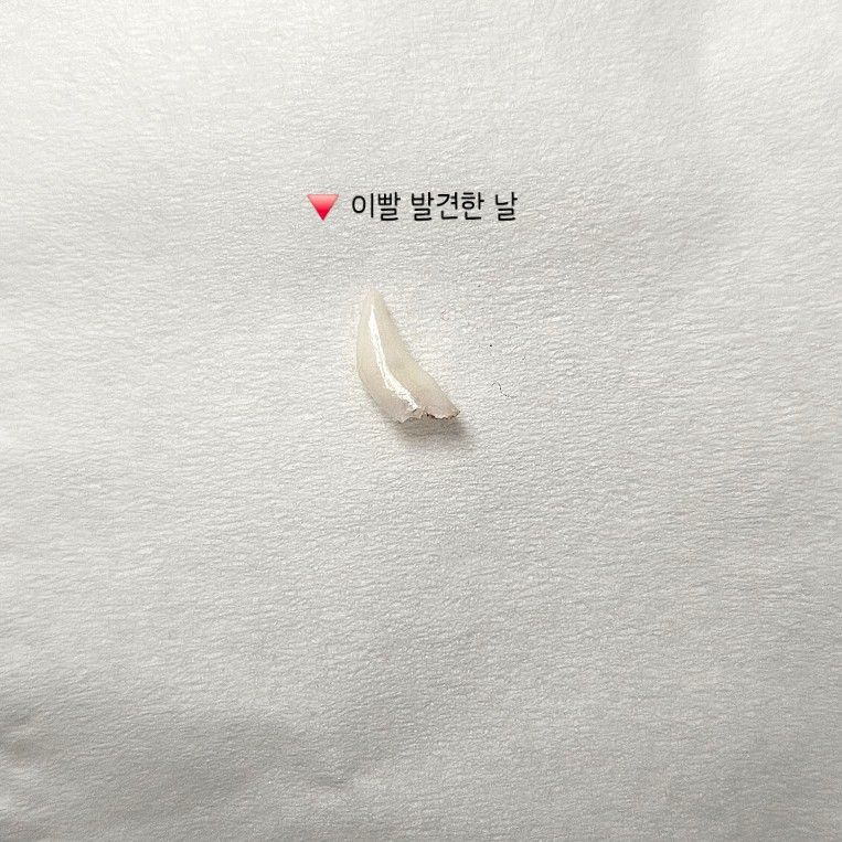6개월 고양이 이갈이 시작! 보리의 유치가 빠졌어요 🦷